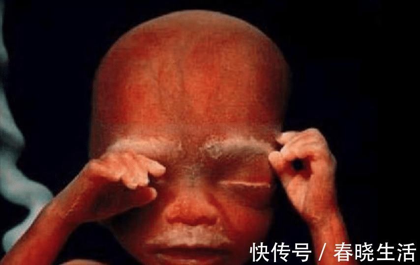 小玉|产后“翻盘”了产检B超医生也忍不住打“暗语”，孕妈别会错意