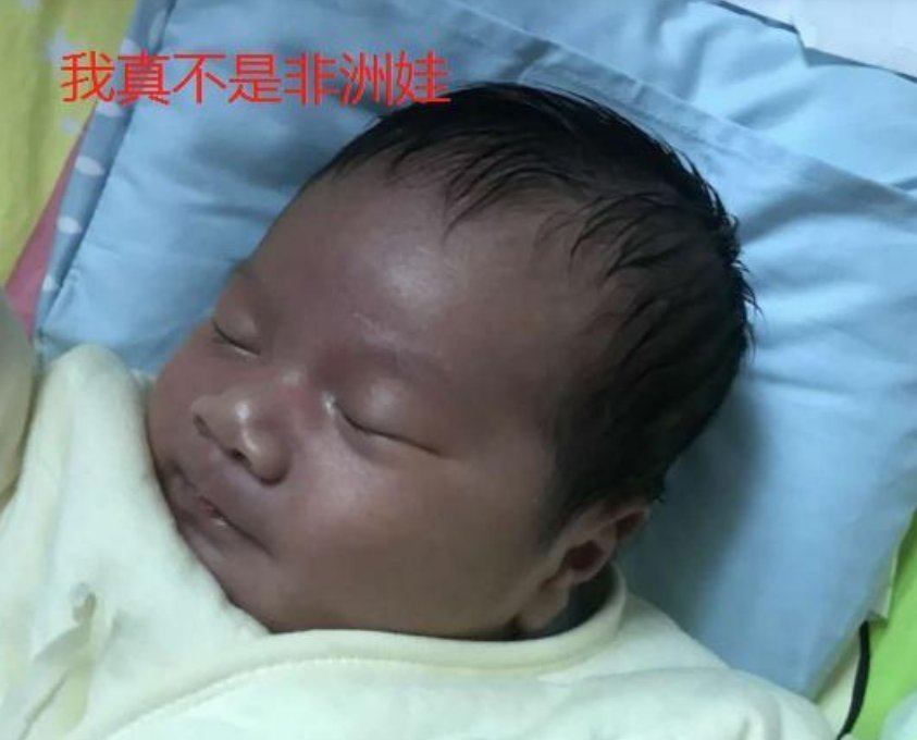 嫌弃|女子生下“黑脸宝宝”,看后一脸嫌弃,护士直言:这才叫高颜值