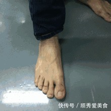 金银花|5个信号一出现,肝火“烧”起来了,自己动手,给肝“去去火”