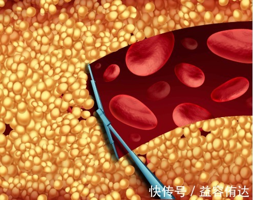 零食|血脂高人群,分享给你6个降血脂的方法,坚持血脂慢慢稳定下来