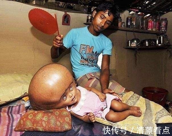 凤凰传奇|有趣的冷门小知识分享，你知道世界上最大的婴儿脑袋有多大吗？