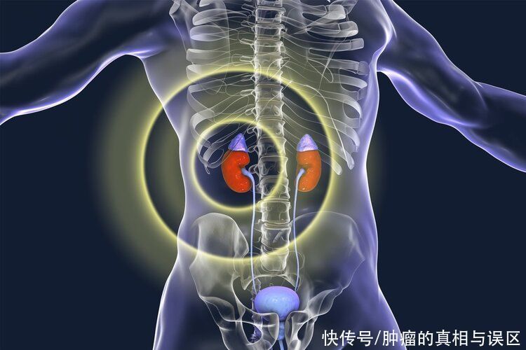 复发|癌症多久不复发才算治愈?4个检查全正常,恭喜你离治愈不远了