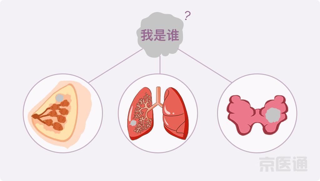 癌症|结节、息肉、囊肿是癌症先兆吗?北肿专家们说出了真相!