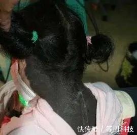 小乐|胎记长在哪里最有福气恕我直言,2种胎记长哪都可能是祸根