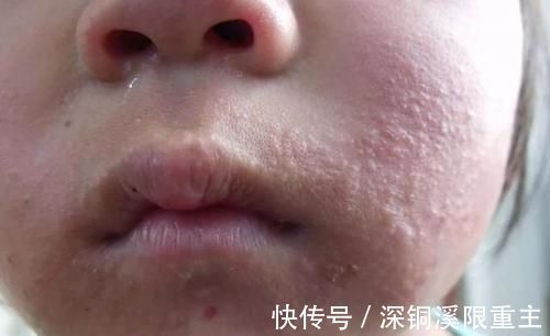 宝宝|宝宝1岁前不能吃的3种水果,宝妈要记牢,对孩子身体没好处