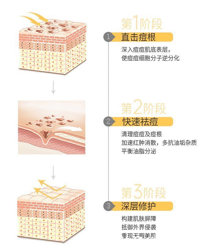 xdg|深扒XDG水杨酸净颜祛痘次抛精华液怎么样？好用吗？