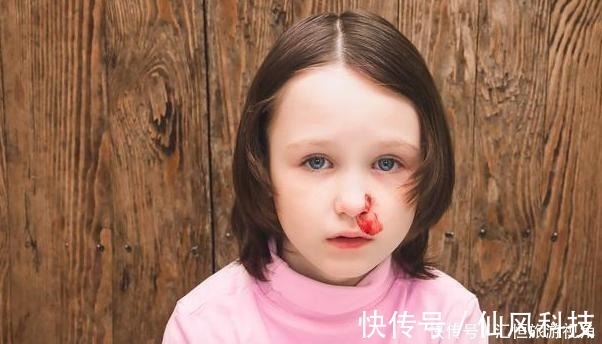 流血|孩子突然流鼻血,妈妈一个动作后,孩子送到医院已无力回天