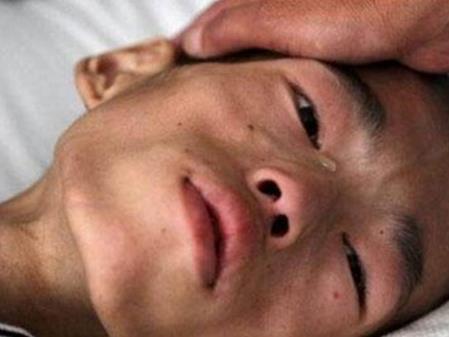 生姜|23岁小伙子患癌症,医生经常吃此物,对身体危害很大