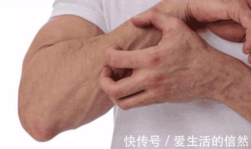 石榴|提醒:血糖偏高的人,平时常吃这4种水果,或有助于稳定血糖