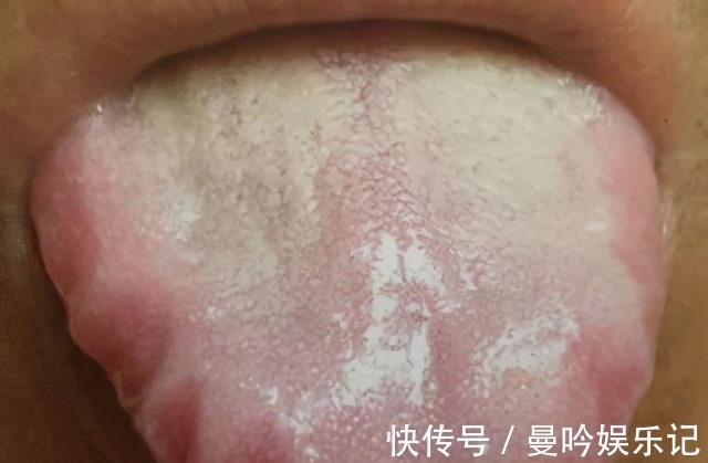 缺乏维生素b12|几块钱一瓶维生素B12,或能“摆平”这4种病,早了解早受益