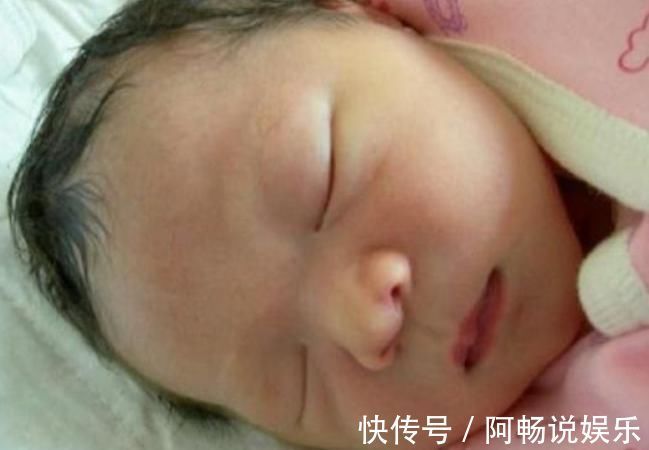 结果|出生6天宝宝还不睁眼，父母急忙带娃就医，医生看到结果却大笑