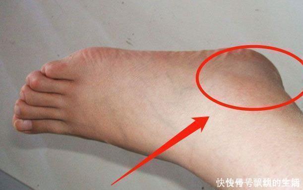 血液循环|肾好的男性,手脚多有4大好现象,你若有1个,说明肾保养的很不错