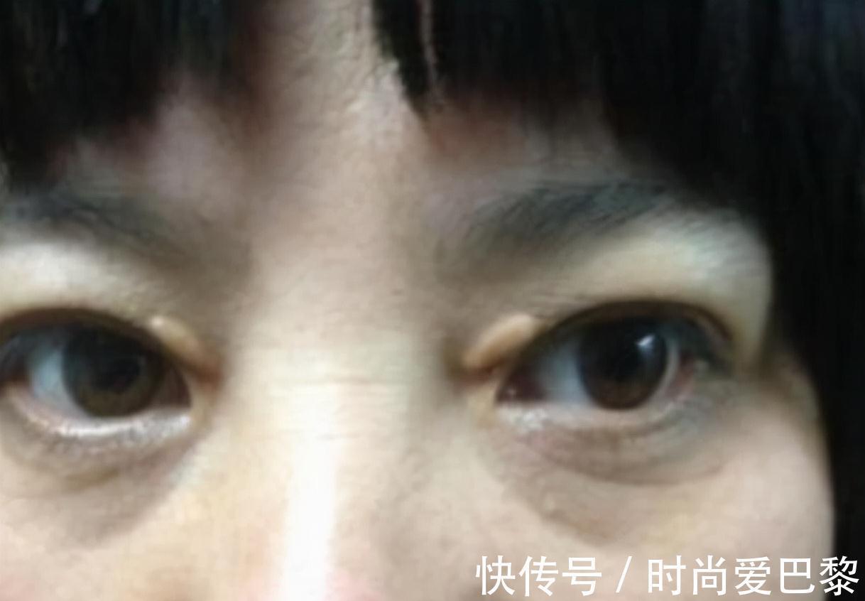 冠状动脉|多走路能降血脂?医生提醒:日常多吃这4物,或比走路效果好