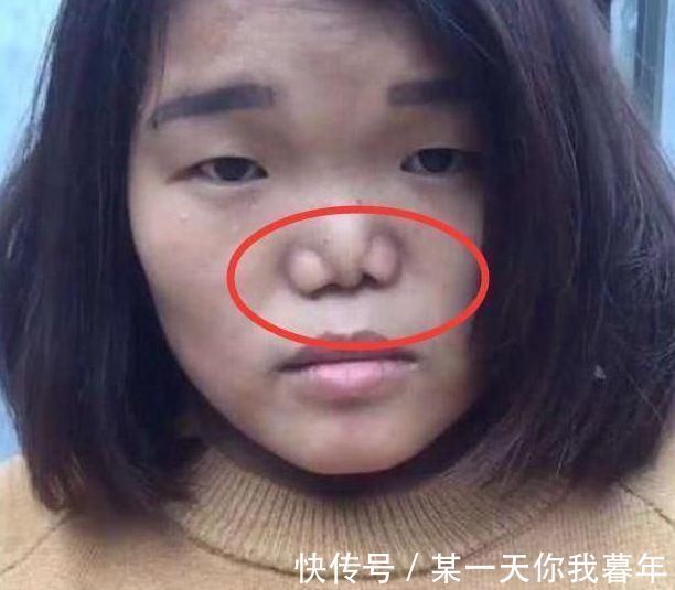 鼻孔|青春期女生“最伤鼻子”的3动作,自认为很舒服,难怪异性缘会归0