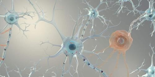 老年痴呆测试猜对3道才正常,1张不会要小心