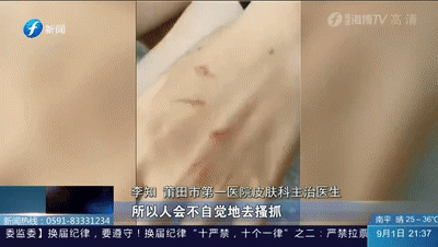 小蟲子|警惕！戶外活動遇上這蟲，要小心！