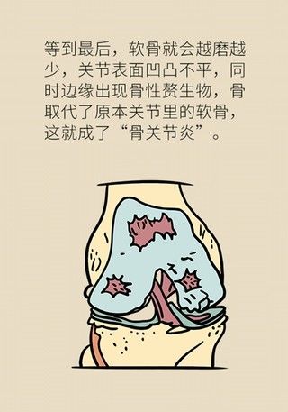 膝盖|别等疼了才就医！忽视这个小问题膝盖离废掉就不远了