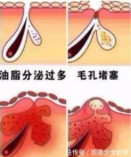 神仙水 护肤顺序不对,用再贵的神仙水都没用!正确护肤步骤新手别错过