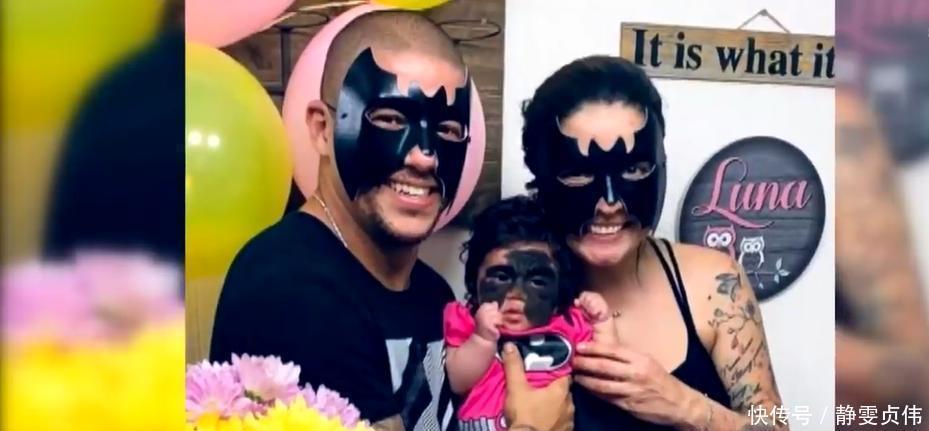 先天性|那个脸上有“蝙蝠”胎记的女孩,如今生活的怎么样?看完很欣慰