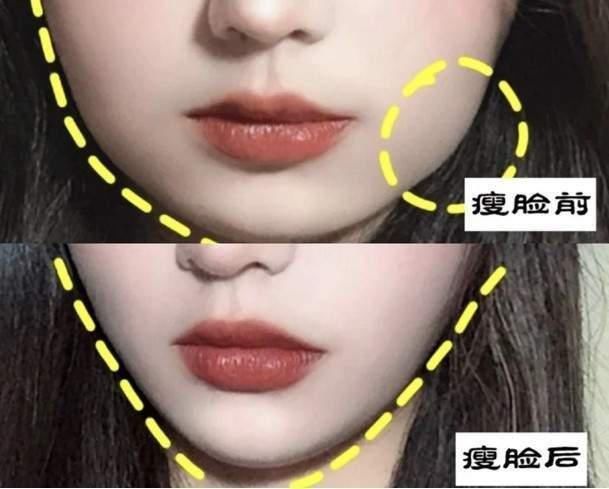 脸胖还有分类型?挑选适合的瘦脸操运动 轻松消除双下巴