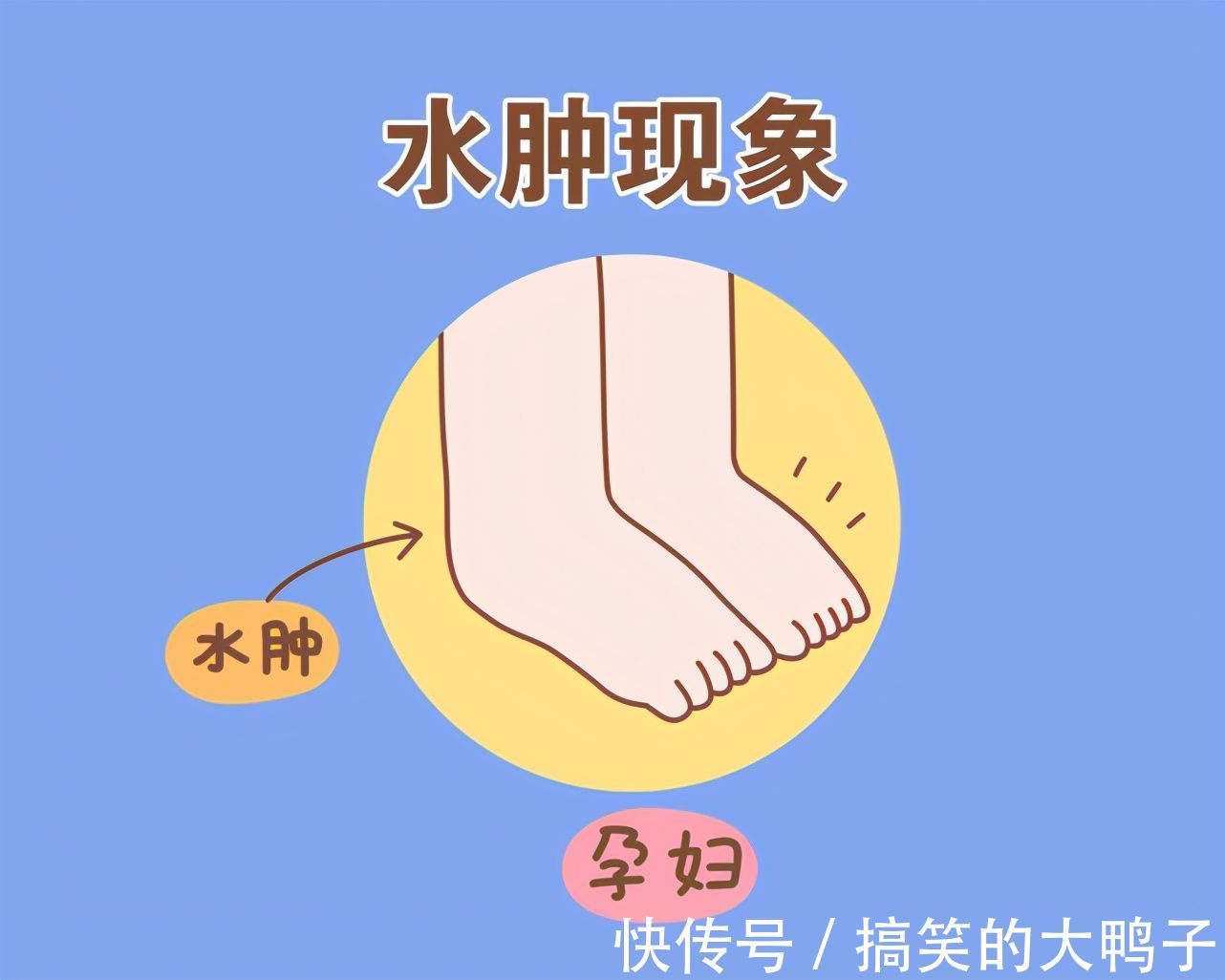 腰酸背痛|胎儿进入“猛长期”,身体会出现五种“不适”,孕妈需及时进补