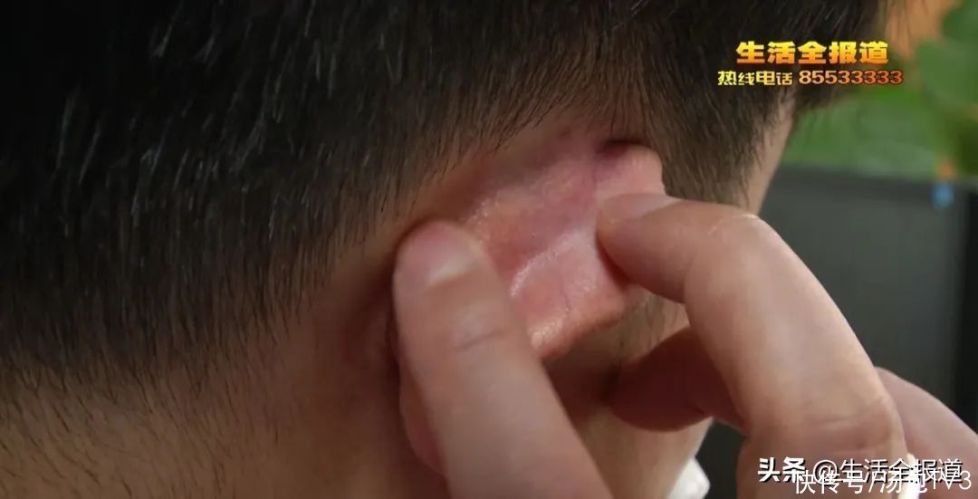 生病|当心！口罩戴久了也会生病 医生提醒这样戴口罩才科学