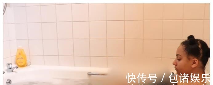 过敏|英国23岁女孩患“水过敏”，洗澡堪比酷刑，全球患者不超过100人