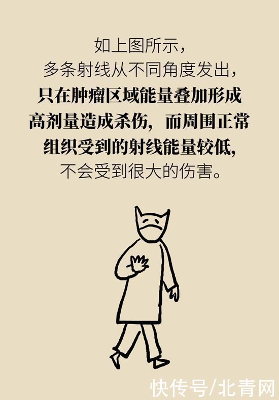 肿瘤|一半以上的肿瘤需要放疗，害怕辐射不如了解一下