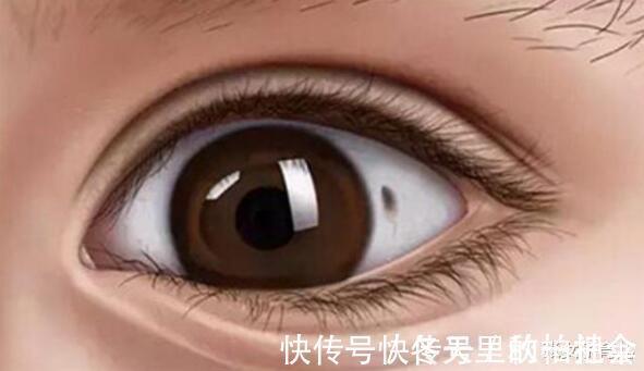 张女子|3岁宝宝眼白出现黑点,怎么回事儿听了医生的答案,终于放心了