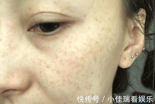 柳女士|女人多喝“牛奶”就能美白?医生坦言:真正有益护肤的,是这3物