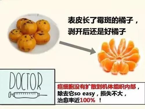 浸润癌|同为癌，原位癌、微浸润癌、浸润癌有何区别？