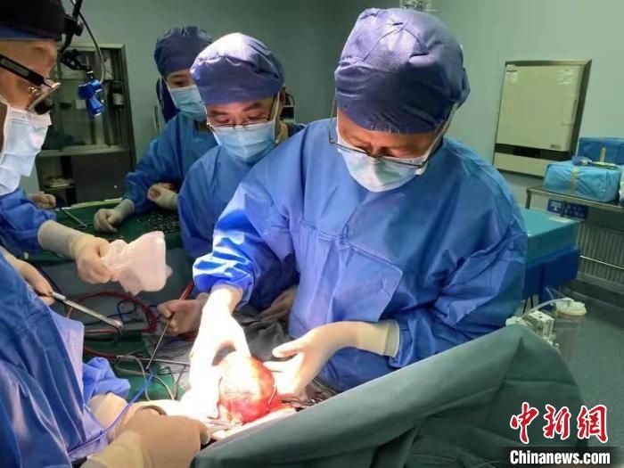 肝左叶|专家携手为早产儿切除少见巨大肝脏肿瘤