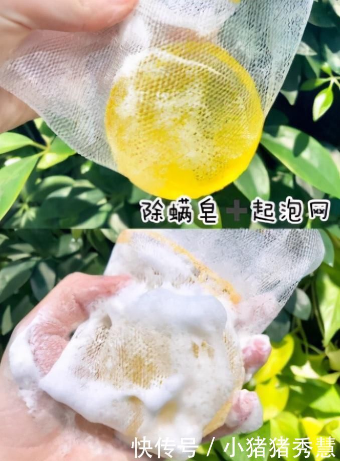 头发|头发油腻,经常抠出“白泥”?别不以为意,其实跟螨虫有大关系