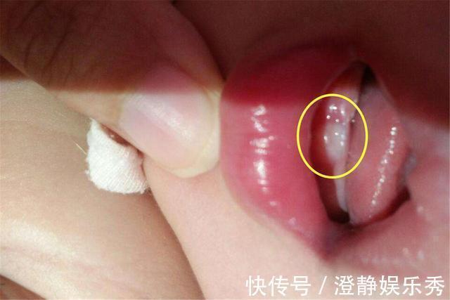 萌发|宝宝出牙的时间、症状表现以及注意事项,一篇讲清,宝妈要了解