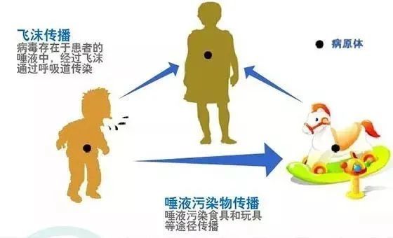 爸爸妈妈必须收藏----流行性腮腺炎防控知识问答