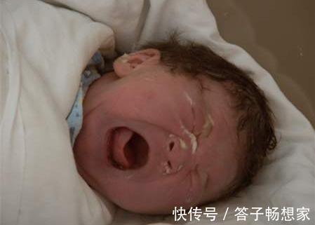 怀胎|怀胎11个月产下“牛奶宝宝”,全家紧张万分,护士恭喜宝妈