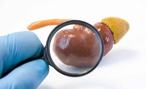 高钙血症|实不相瞒！这种症状若出现，或是肾癌已到来，千万别再拖！