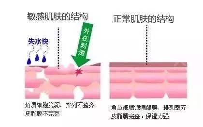 敏感肌|敏感肌到底可不可以化妆？平时护肤需要注意什么？