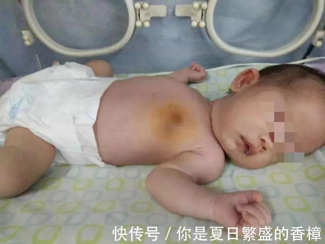 孩子|婆婆在宝宝身上动“手脚”,妈妈掀开衣服后大哭,网友迷信害人