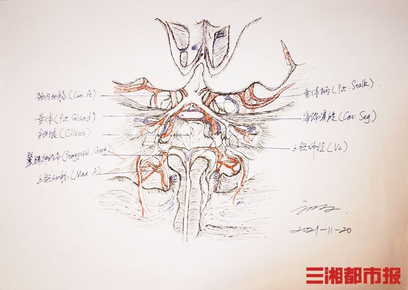 小雯|19岁女孩生理期紊乱视力减退，竟是脑子里出了问题