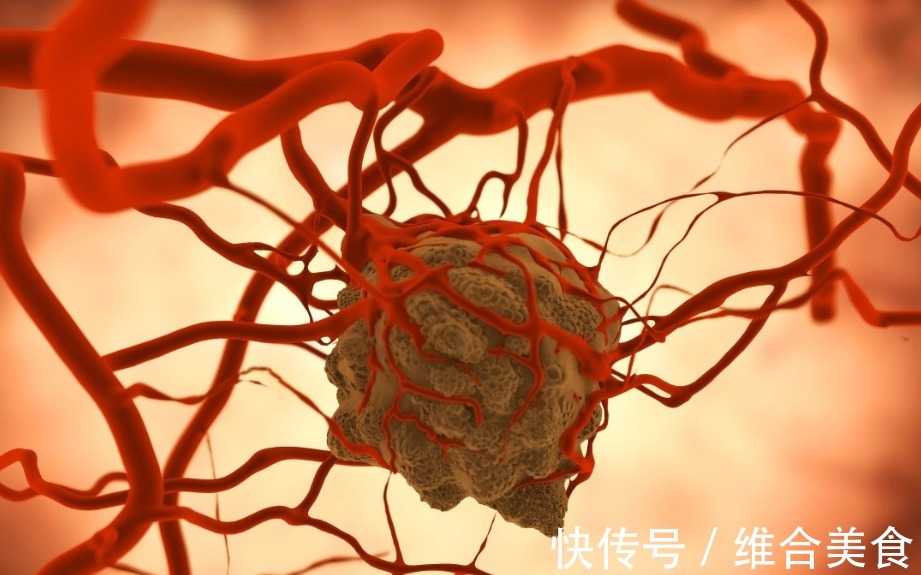 肿瘤|肺癌来临,睡觉先知!医生直言肺部有癌的人,睡觉有这些表现