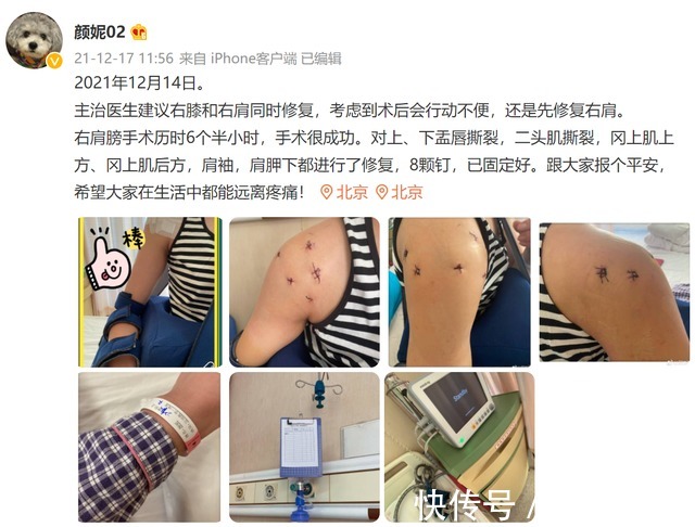 冈上肌|心疼!女排奥运冠军肩膀植入8颗钉,还得做右膝手术,颜妮报平安