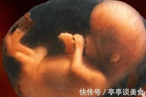 肚子|为什么有人怀孕的时候肚子大，而有人怀孕的时候肚子小？