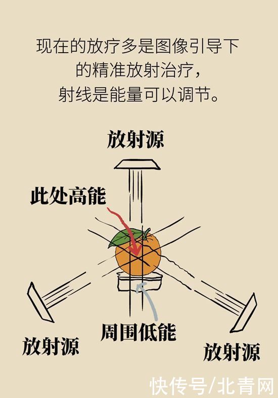 肿瘤|一半以上的肿瘤需要放疗，害怕辐射不如了解一下