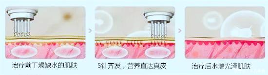 这些医美项目比你们所有的化妆品还有用!