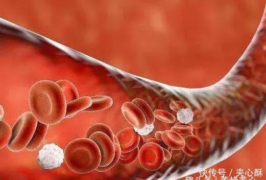 增加|冬季是血栓高发季,生活中我们应该如何预防血栓的形成呢?