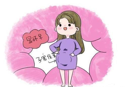 子宫前位|同样是孕妇,同样的月份,肚子大小却不一样,显怀早晚代表什么