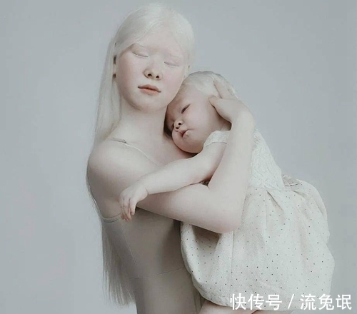 生而白首|一对罕见的“月亮姐妹”,被人嘲讽14年,拍完一组照片后惊艳众人