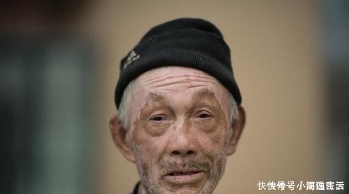 白血病|78岁老人因肝癌离世，医生太多人还在吃，家里都有