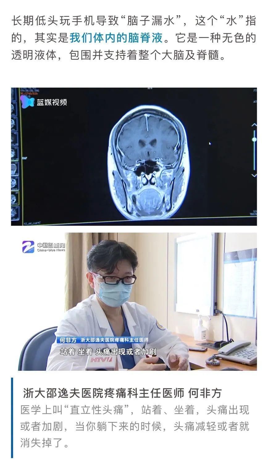 浙大|经常玩手机、这些情况下头疼，小心！你可能“脑子进水”了